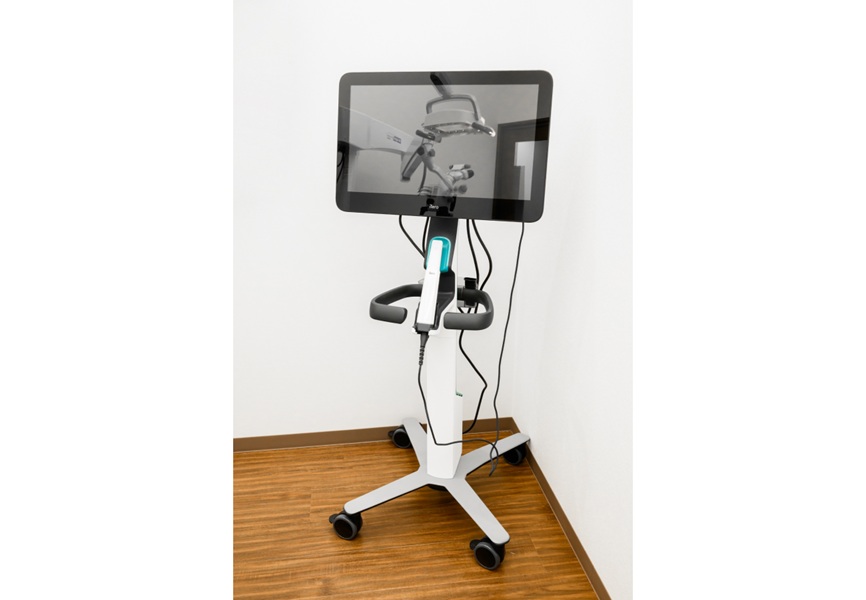 iTero 口腔内スキャナー